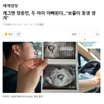 개그맨 장동민, 두 아이 아빠된다