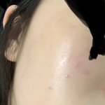 [댓글부탁해] 나 <b>약속</b> 있는데 갑자기 피부 뒤집어졌는데 제발 들어와줘