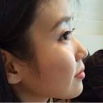 나 ㅈㄴ 아이유<b>코야</b>