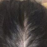 [댓글부탁해] 이 정도면 <b>탈모</b>야? 진짜 심각해ㅠㅠ