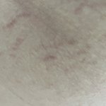 튼살있는 애들 <b>크림</b> 꼭 발라라