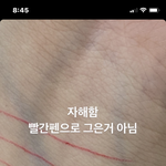 나 <b>자해</b> 흉터 있는데 친구한테