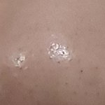 블랙<b>헤드</b> 없애는 제품 추천 좀 ㅠ
