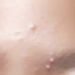 [댓글부탁해] 약혐) 여드름 <b>더블</b>로 남,,