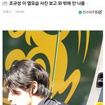 코 성형 <b>왠만</b>하면 하지마..