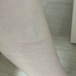 [댓글부탁해] 제모 하는데 <b>상처</b>났음 어떡함?ㅜㅜㅜ