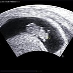 <b>위로</b> 좀 해주세요.