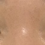 [댓글부탁해] 쌍수 <b>재수술</b> 하려고 하는데