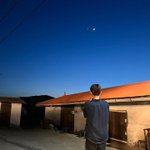 [드루와] 엥 나 잇몸 <b>나사</b>박은 거 빠짐;