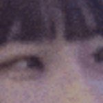 나 안검<b>하수</b> ㄹㅇ 개심한데 너무 스트레스받는다
