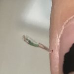 헠 핸드폭 액정 파편 손꾸락에 <b>박힘</b>