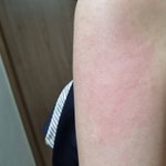 방금 교통사고 났는데