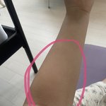 [댓글부탁해] 이 <b>팔목</b> 살은 어떻게 빼나욤?
