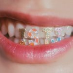[NCT드림] 제노 이번에 ㄹㅇ로 컨셉 <b>소화력</b> 미쳤다