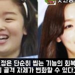 나 <b>치아</b> 이런데