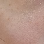 [댓글부탁해] 이거 <b>설마</b> 모공임..?
