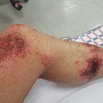 [G랄같은나] 세상사는 인생사 나보다 더러운 인생잇나요 이제는 모든게...