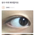 와 뒷트임이 이렇게 될<b>수도</b> 있어??