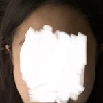<b>안면</b>윤곽 고민중인데 얼굴형 좀 봐주라