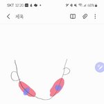 사각턱 보톡스 맞아본애들 들어<b>와바</b>