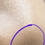 화장하면 <b>코에</b> 오돌토돌하게 나는거잇자나