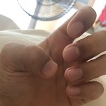 <b>단지증</b>… 많이 정 떨어지냐…