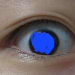 [댓글부탁해] <b>이란</b> 눈 쌍커풀 수술해도 ㄱㅊ음?