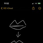 <b>필러</b>로 <b>윗입술</b> 이렇게 까뒤집을 수 있어?