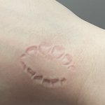 나 <b>앞니</b> ㅈㄴ 크네