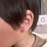 [방탈죄송] 어린이집 학대 당했어요.