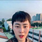 하성운상병 피부 볼 사람