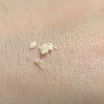 <b>두피</b> 긁으면 이런거 나오는거 정상이야?