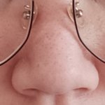 [드루와] 콧볼축소 후기 쪄옴