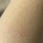 [댓글부탁해] 약혐)팔에 이거 뭐임?ㅜㅠㅠ
