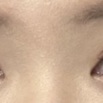 너네 <b>이</b> <b>눈</b>이면 쌍수 할거임?