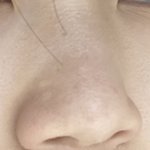 내 코 진짜 못생김