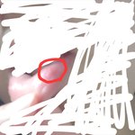 [이것좀봐줘] 이거 여드름임?