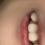 나보다 <b>치열</b> 심각한애 없을듯