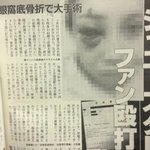 [모두드루와] 울나라 아이돌도 <b>사생</b> 이렇게 패면좋겠다ㅋㅋ