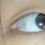 [댓글부탁해] 몽고<b>주름</b> 쌍수없이 앞틤만 해두대나..?