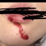 와 나 입술 뜯었는데 <b>보</b><b>셈</b>;;