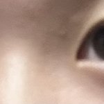 나 쌍수하면 인상너무 <b>진해</b>질거가틈?