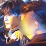 김지웅 얼굴이 왜이래