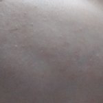 [뷰티] 이런거 어떻게 없애는거야?? 꿀<b>팁</b>좀..ㅠㅠ