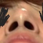 이건 <b>수술</b>한 코임.??