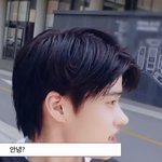 라이즈 <b>소희</b> 코 봐봐…잘 된 게 아님