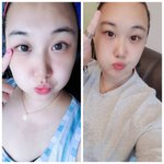 [비키니입자] 다이어트<b>전후</b>