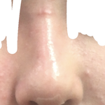[댓글부탁해] 고1 코<b>필러</b> 입술<b>필러</b>