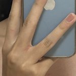 <b>야들</b>아 나 승모근 심하냐