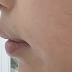 [드루와] 나 <b>돌출</b>입 많이 심함??